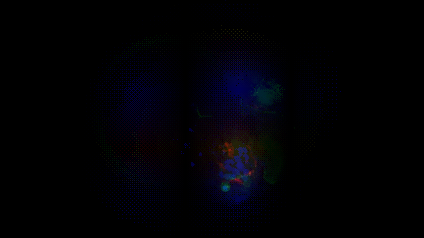 肠癌类器官（GIF）